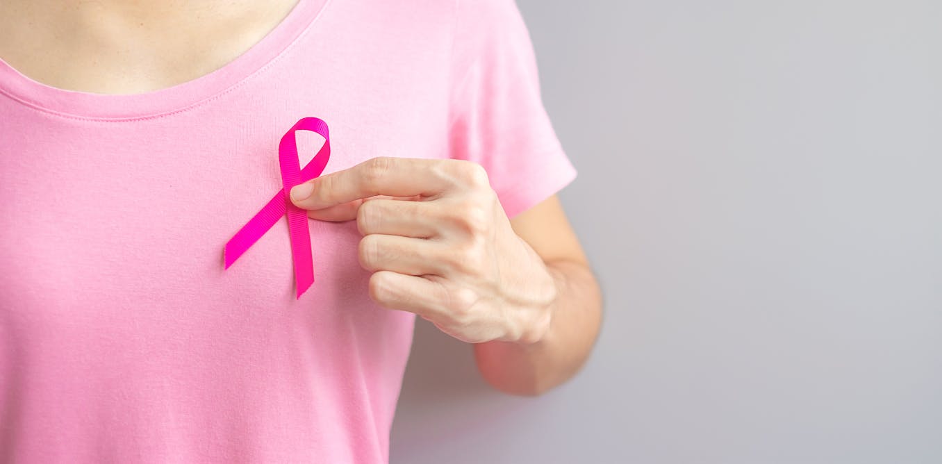 Lymphedema, a little known side effect of breast cancer
